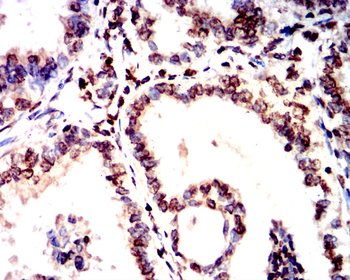 ATF4 Antibody