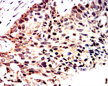 ATF4 Antibody