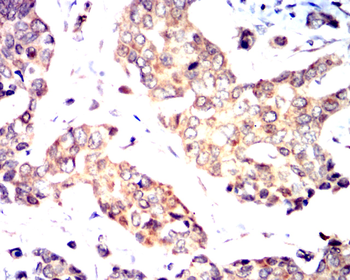 CD274 Antibody