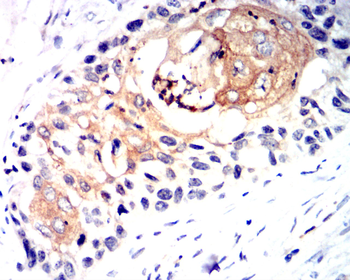 CD274 Antibody