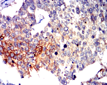 CD274 Antibody