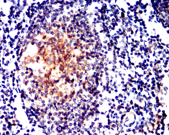 CD274 Antibody