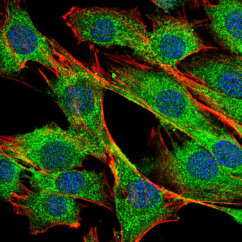 PTEN Antibody