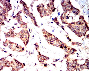 PTEN Antibody