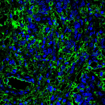 PTEN Antibody