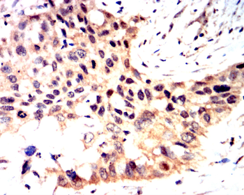 PTEN Antibody
