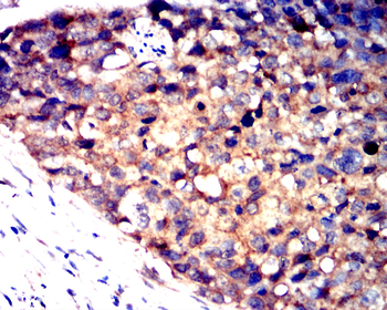 PTEN Antibody