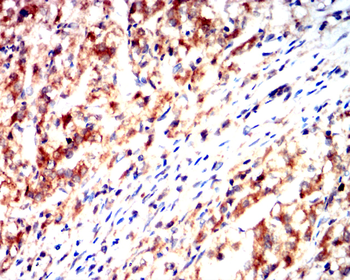 PTEN Antibody