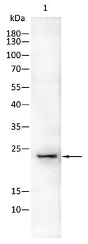 TSPO Antibody