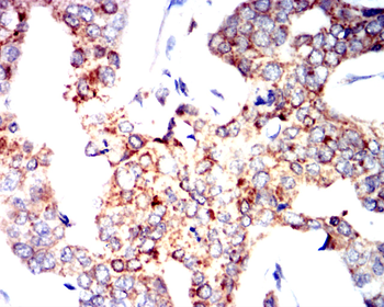 TSPO Antibody