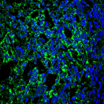 TSPO Antibody