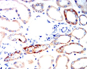 TSPO Antibody