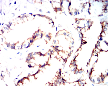 TSPO Antibody