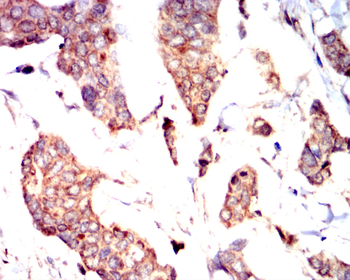 VEGFA Antibody