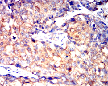 VEGFA Antibody
