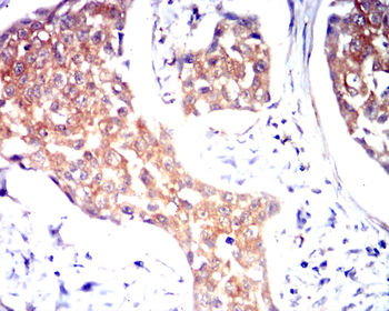 VCAM1 Antibody