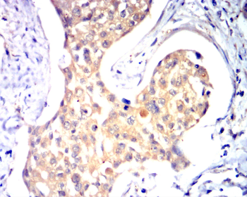 COL10A1 Antibody