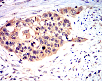 COL10A1 Antibody