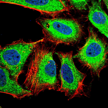 WT1 Antibody