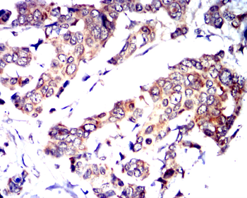 TSG101 Antibody
