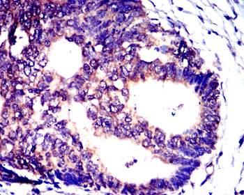 TSG101 Antibody