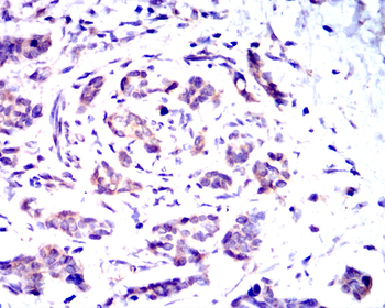 TSG101 Antibody