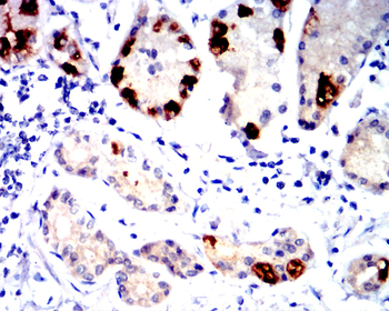 TSG101 Antibody
