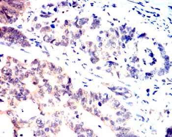 MAPK14 Antibody