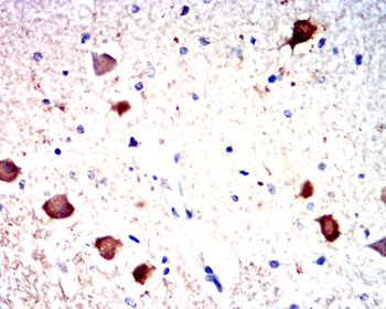 CALB2 Antibody