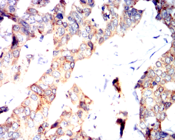 CALB2 Antibody