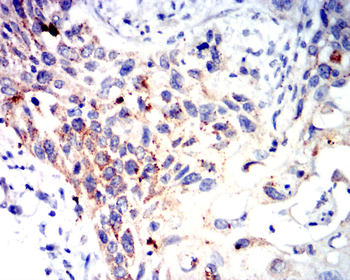 CALB2 Antibody