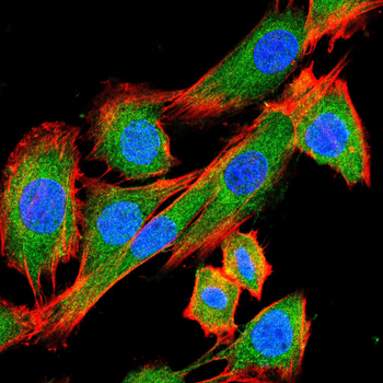 NGF Antibody