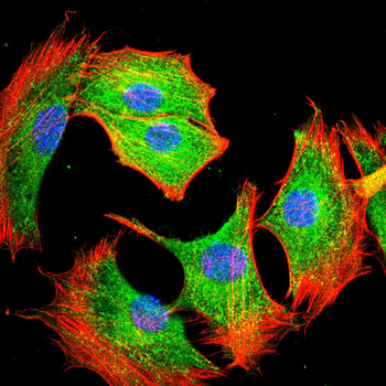 TP53 Antibody