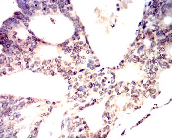 TP53 Antibody
