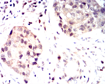 TP53 Antibody