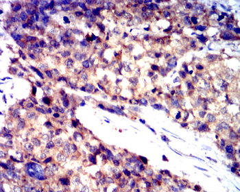 TP53 Antibody