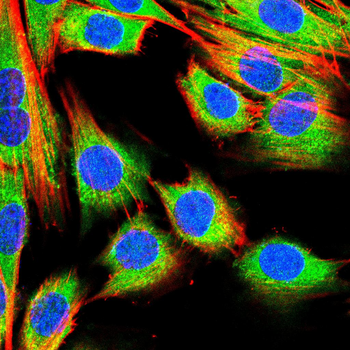 S100A4 Antibody