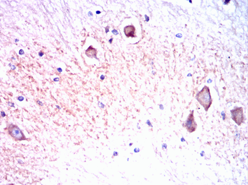 SLC2A3 Antibody