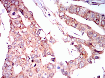 SLC2A3 Antibody