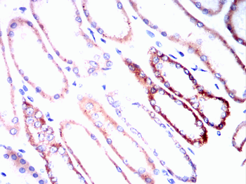 SLC2A3 Antibody