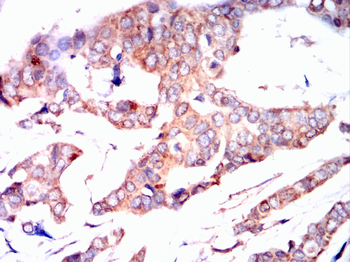 FOXO1 Antibody