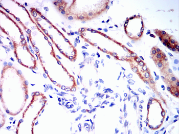 FOXO1 Antibody
