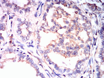 FOXO1 Antibody