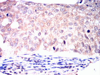 FOXO1 Antibody