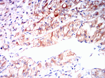 FOXO1 Antibody