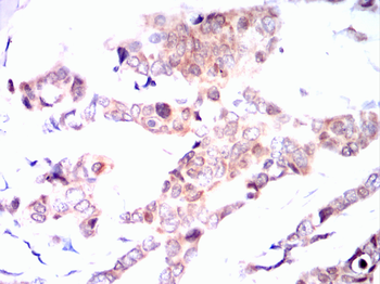 LEPR Antibody
