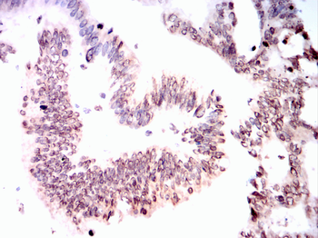 CCNE1 Antibody