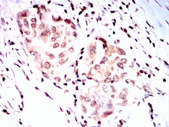 CCNE1 Antibody