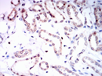 CCNE1 Antibody
