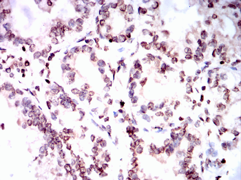 CCNE1 Antibody